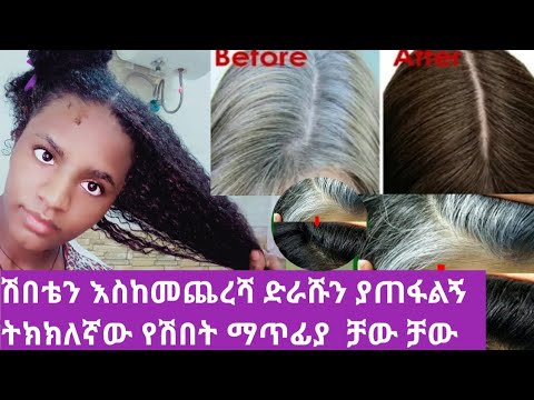 ሽበቴን በ1ወር እስከመጨረሻ ድራሹን ያጠፋልኝ ትክክለኛው የሽበት ማጥፊያ  ቻው ቻው