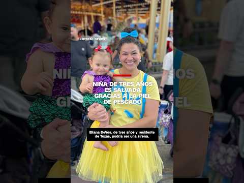 Niña de tres años es salvada gracias a la piel de pescado