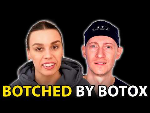 I Got BOTCHED By Botox | Plastic Surgeon Reacts