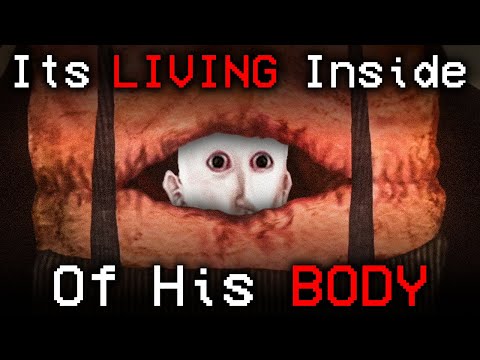 The PARASITE Torturing Him From The INSIDE | Doctor Nowhere