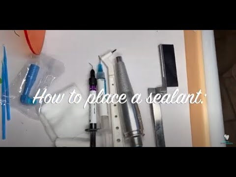 How to Apply a Dental Sealant