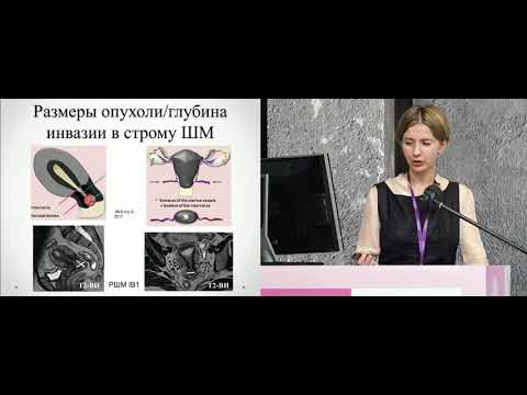 «Подводные камни» МР-диагностики рака шейки матки: что нужно знать клиницисту