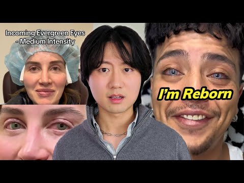 The Insane World of Eye Color Changing Surgeries