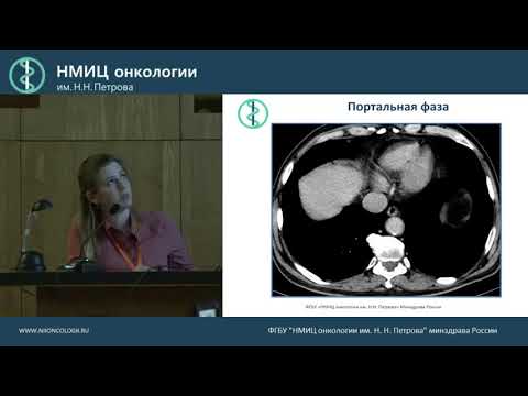 CT for pancreatic tumors How it should be done