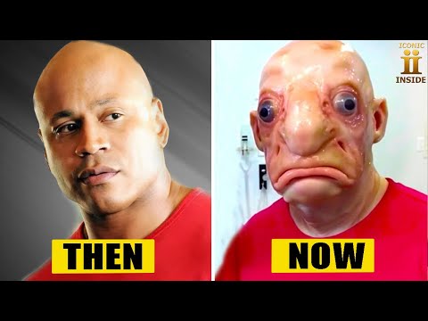 12 Celebs Who Regretted Changing Their Race with Surgery