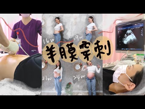 羊膜穿刺會痛嗎😱？高層次超音波的感想？聊聊懷孕六個月的心境！🥰