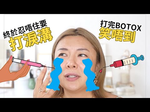 💉第一次醫美失敗經歷 | 公開打過針劑項目 | 水光槍vs水光針 | 打botox 瘦面咀嚼肌 | 填充淚溝 | ￼嘴唇filler