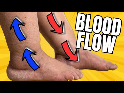 How To Improve Leg Circulation Up To 74%; Complete Details