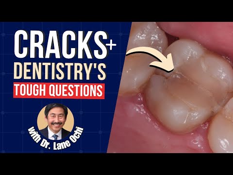 Cracked Teeth and Dentistry's Tough Questions with Dr Lane Ochi - PDP175