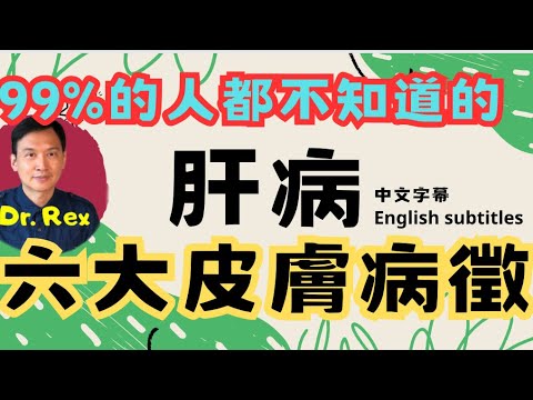 (中英字幕EngSub)99%的人都不知道的肝病皮膚症狀 skin signs of liver disease that most people don't know