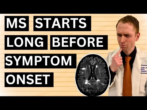 Multiple Sclerosis Starts Years Before Symptom Onset