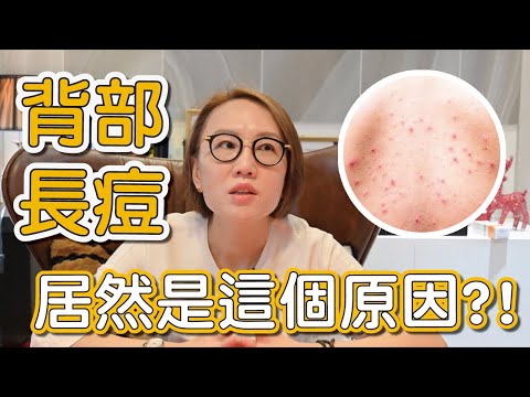 為什麼背上會長青春痘？背上的青春痘要怎麼做青春痘治療？