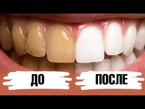 How to whiten your teeth at home? 2 ingredients and your toothpaste is ready!🔥