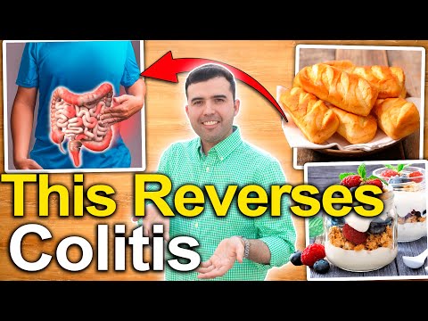 How to Treat Ulcerative Colitis? - Foods and Natural Remedies to Cure Ulcers in the Colon