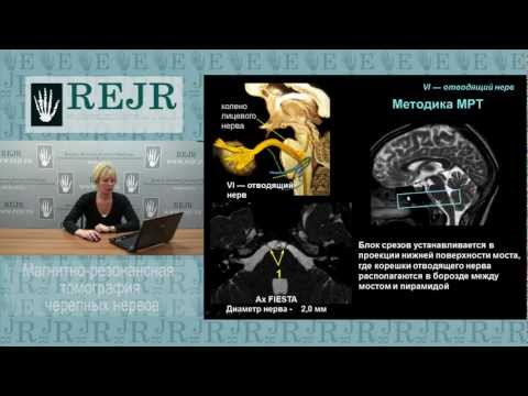 МРТ черепных нервов