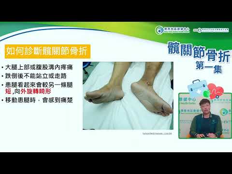 髖關節骨折 第一集