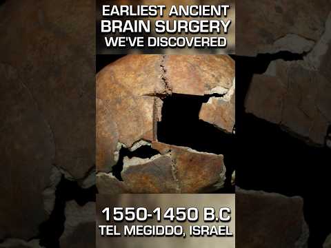 3,500 YEAR OLD BRAIN SURGERY DISCOVERED! EARLIEST SO FAR! #ancienthistory #ancientmedicine