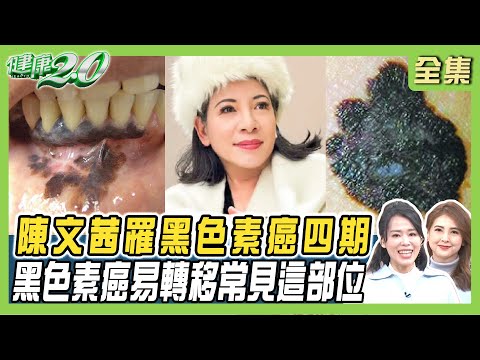 陳文茜罹更惡黑色素癌四期 1藥物致命後遺症！黑色素癌易轉移 常見這部位！林美照與女兒全罹癌 6種癌易遺傳！ 健康2.0 20241228【完整版】陳欣湄 韋汝 吳鴻誠 柳朋馳 鄒瑋倫 劉怡里 潘瑋翔