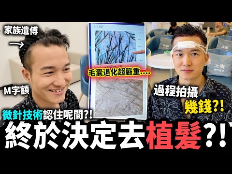 【深圳植髮】老公禿頭⚠️植髮全過程💇🏻幾錢？不剃髮、傷口細、24小時可洗頭！專利微針技術💉僅此一間最可靠！術後護理 同一間搞掂✅｜福田口岸附近｜#大麥微針植髮 #深圳植髮 #植髮 #大麥植髮