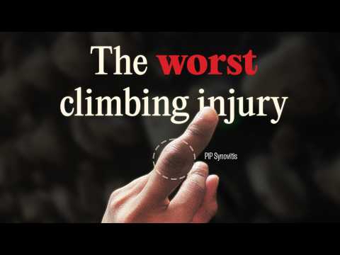 The Art of Starting Over: climbing injuries and recovery (feat. @HoopersBeta )