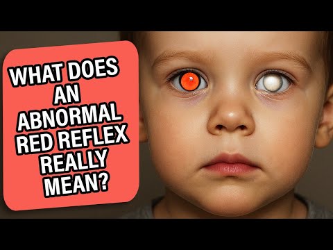 What Does an Abnormal Red Reflex Really Mean? | Knock Knock Eye