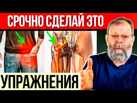 I SHOW HOW TO QUICKLY CURE A PINCHED SCIATIC NERVE WITH 3 EXERCISES