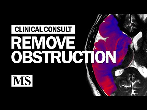 Clinical Consult: Remove The Obstruction