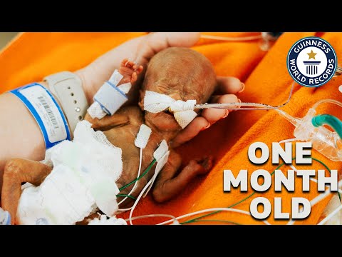 World's Most Premature Baby | Guinness World Records