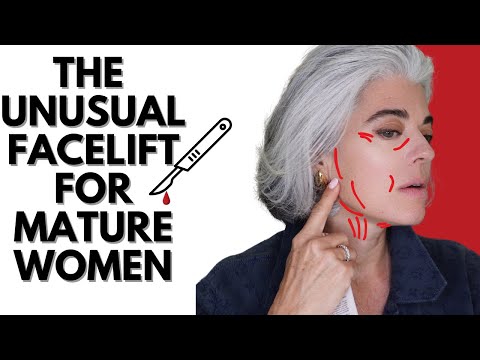 THE UNUSUAL FACELIFT WOMEN OVER 50 ARE FLOCKING TO