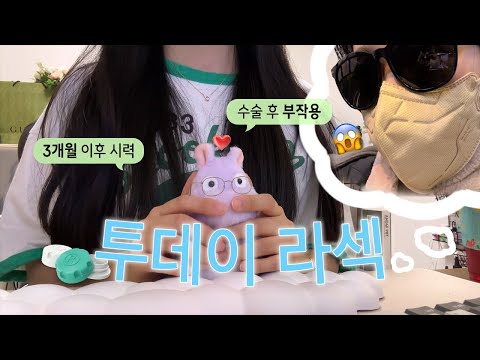 Today LASIK 3-Month Review - Side Effects and Current Vision