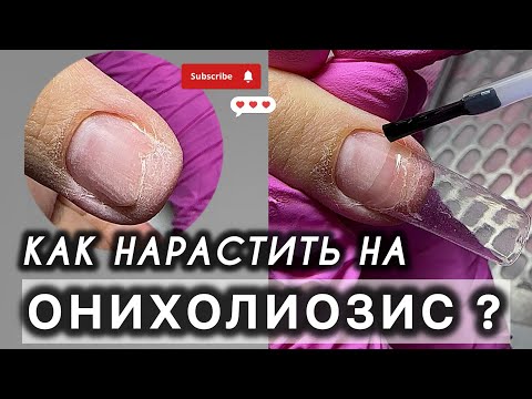 ОНИХОЛИЗИС КАК НАРАСТИТЬ НОГТИ? ДИП СИСТЕМА #подология #подолог #обучениеподологии #аленалаврентьева