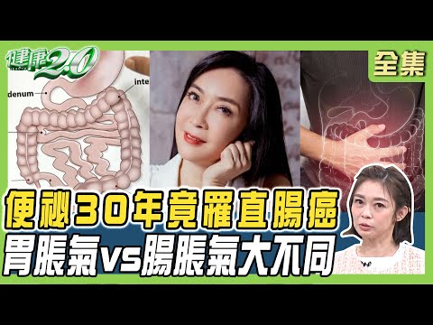顧婕脹氣.便祕長達30年 竟罹直腸癌4期！常脹氣是腸胃發炎警訊 胃脹氣vs.腸脹氣大不同！健康2.0 20241124【完整版】鄭凱云 陳麗華 陳樞鴻 葉秉威 劉怡里 雷議宗