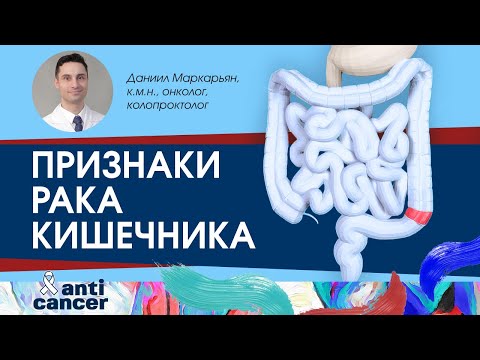 Признаки, которые могут говорить о раке кишечника