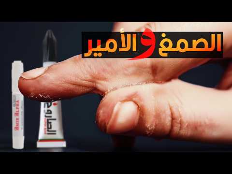 ليه الأمير والصمغ بيلزقوا في الصوابع بالشكل البشع ده؟