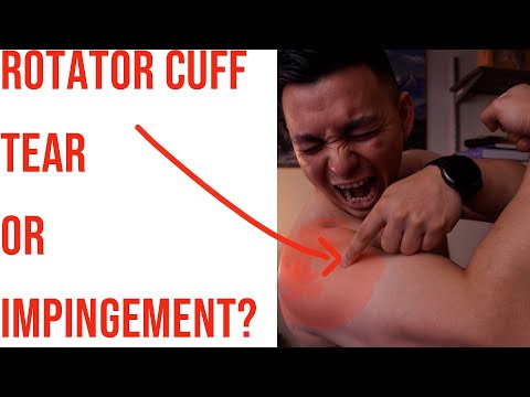 Shoulder Impingement or Tear? Find out FAST.