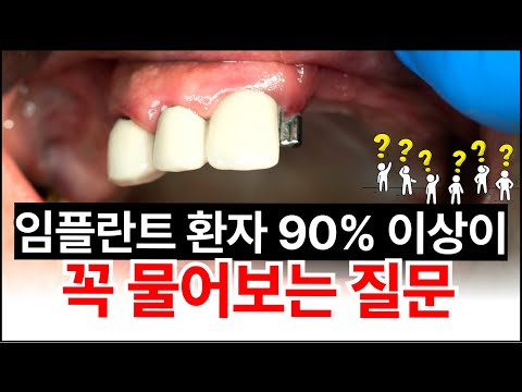 '์ด๊ฑฐ'๋ชจ๋ฅด๋ฉด ๋์ค์ ํํํด์!!๐ฃ ๊ฐ์ฅ ๊ถ๊ธํดํ๋ ์ํ๋ํธ ์ง๋ฌธ Q&A #์ํ๋ํธ