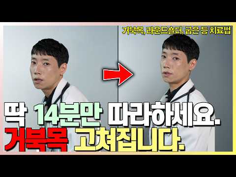 이렇게 해야 거북목, 굽은 등, 라운드 숄더까지 다 펴집니다 l 상부교차증후군 교정법 l 닥터딩요