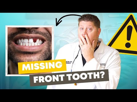 The 5 Best Options to REPLACE Your Missing Front Tooth (Dental Implants, Bridges & More)