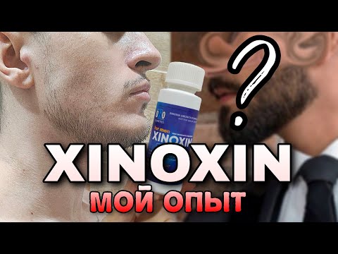 Ксиноксин (Xinoxin) или как я пытался отрастить бороду | Результаты ксиноксина | Ксиноксин vs Минокс