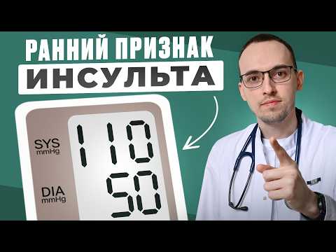 ТОП-5 ОПАСНЫХ Предвестников ИНСУЛЬТА. Как СПАСТИ СОСУДЫ Головного Мозга?