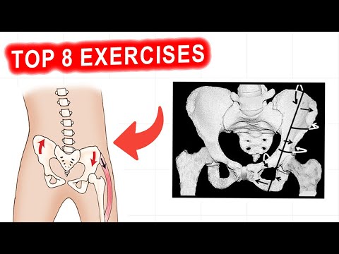 How to fix LEFT AIC pattern (Full protocol for beginners, to fix LATERAL PELVIC TILT)