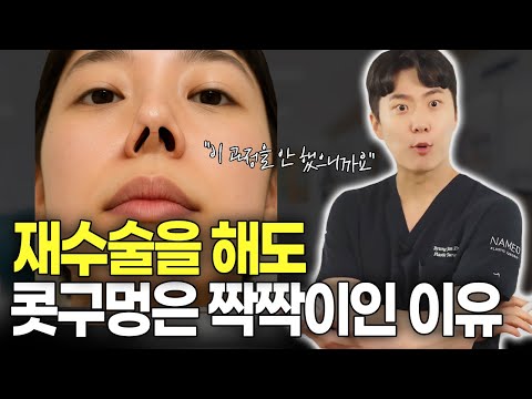 콧구멍 비대칭이 안 고쳐지는 진짜 이유 (해결법 有)