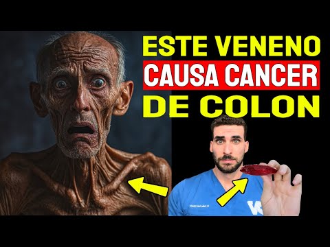 ¡EL PEOR VENENO que CAUSA CÁNCER de COLON! (CANCER de INTESTINO)