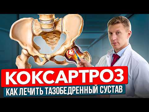 ЛЕЧЕНИЕ КОКСАРТРОЗА | Доктор Еремин Иван Константинович