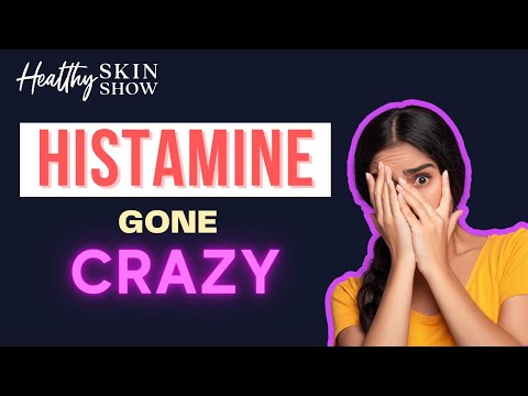 MCAS Mast Cell Activation Syndrome Symptoms + Treatment (It's Histamine Hell) | Jill Carnahan