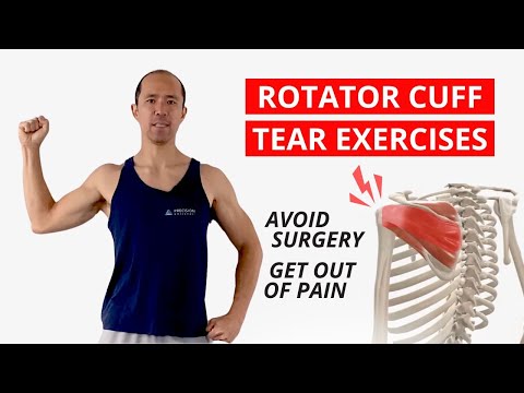 3 Keys to Rehab a Rotator Cuff Tear & AVOID Surgery [NEW EXERCISES]