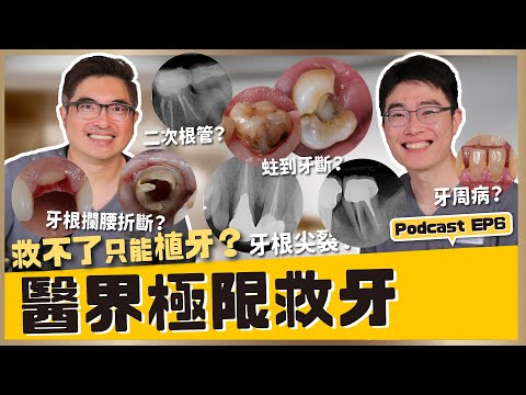 醫界極限救牙真相公開！牙齒斷掉還有救？救與不救的分界線：牙科臨床上的極限挑戰 ft. 許文斌｜【祐民牙醫－隱適美旗艦店】鑽石級楊大為醫師