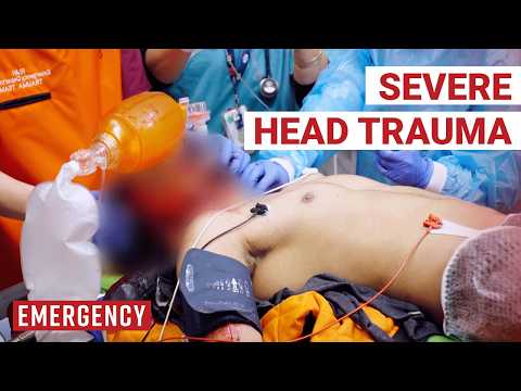 Motorcyclist Thrown Head On Into Windscreen Is Critical! | Emergency