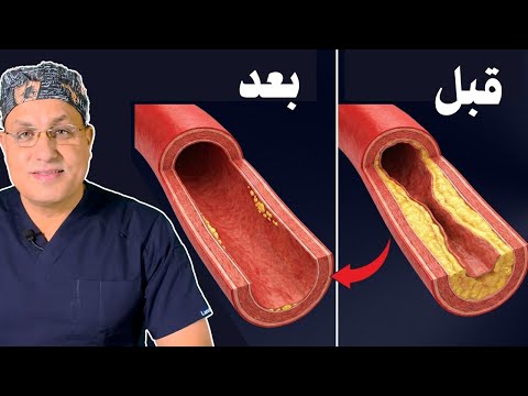 أفضل وجبة تفتح الشرايين وتحميك من الجلطات | كلام علمي بالأدلة