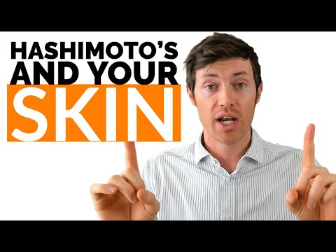 15 Skin Conditions CAUSED by Hashimoto's